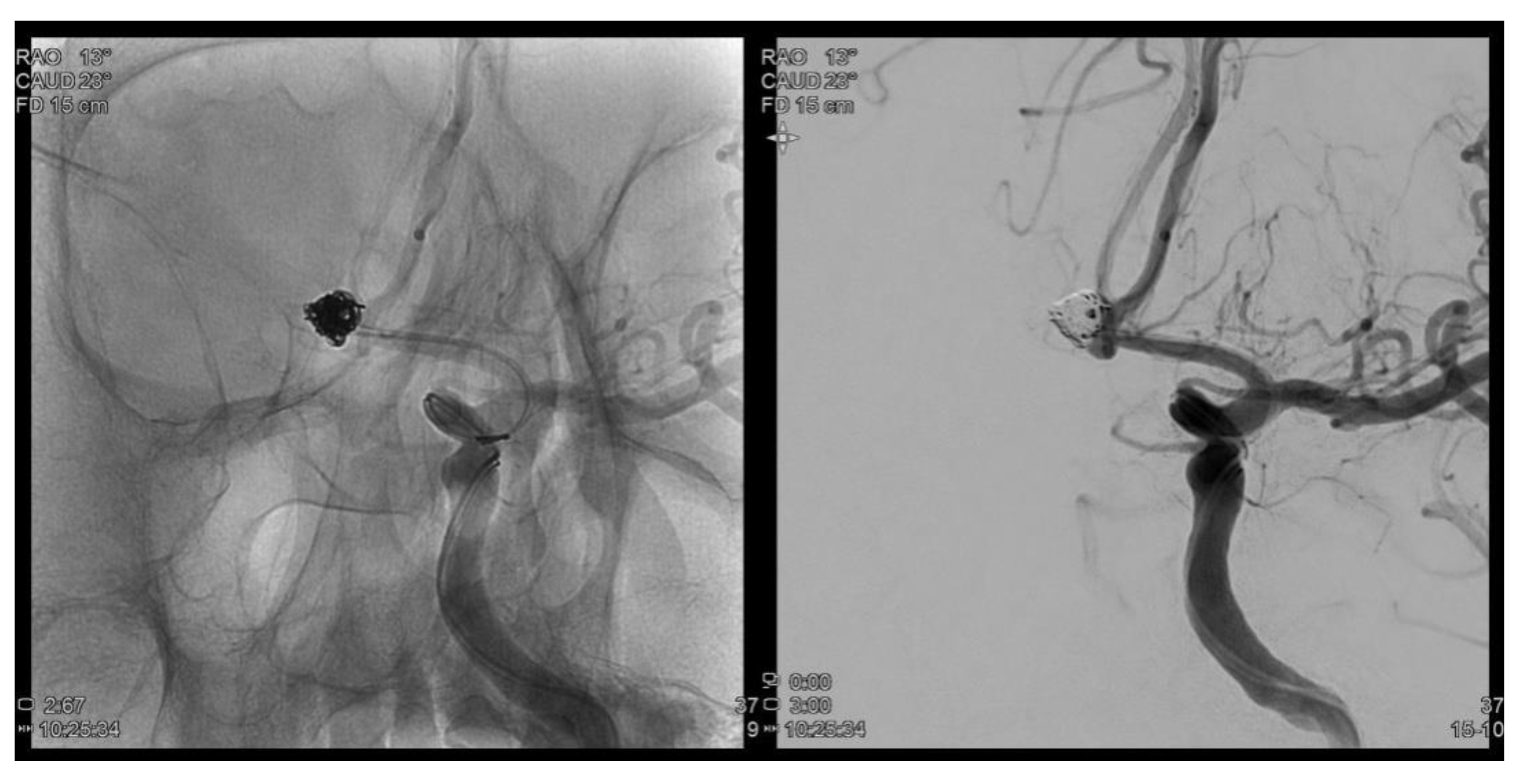 Brainsci 11 00542 g001 Brainsci 11 00542 g001