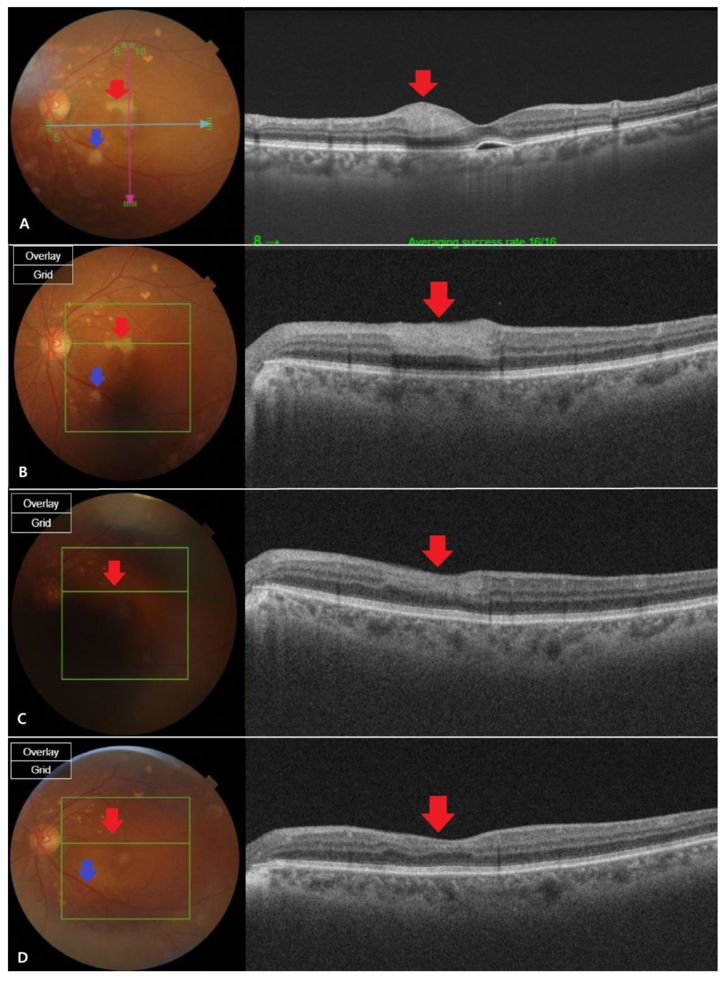 Brainsci 11 00542 g002 Brainsci 11 00542 g002