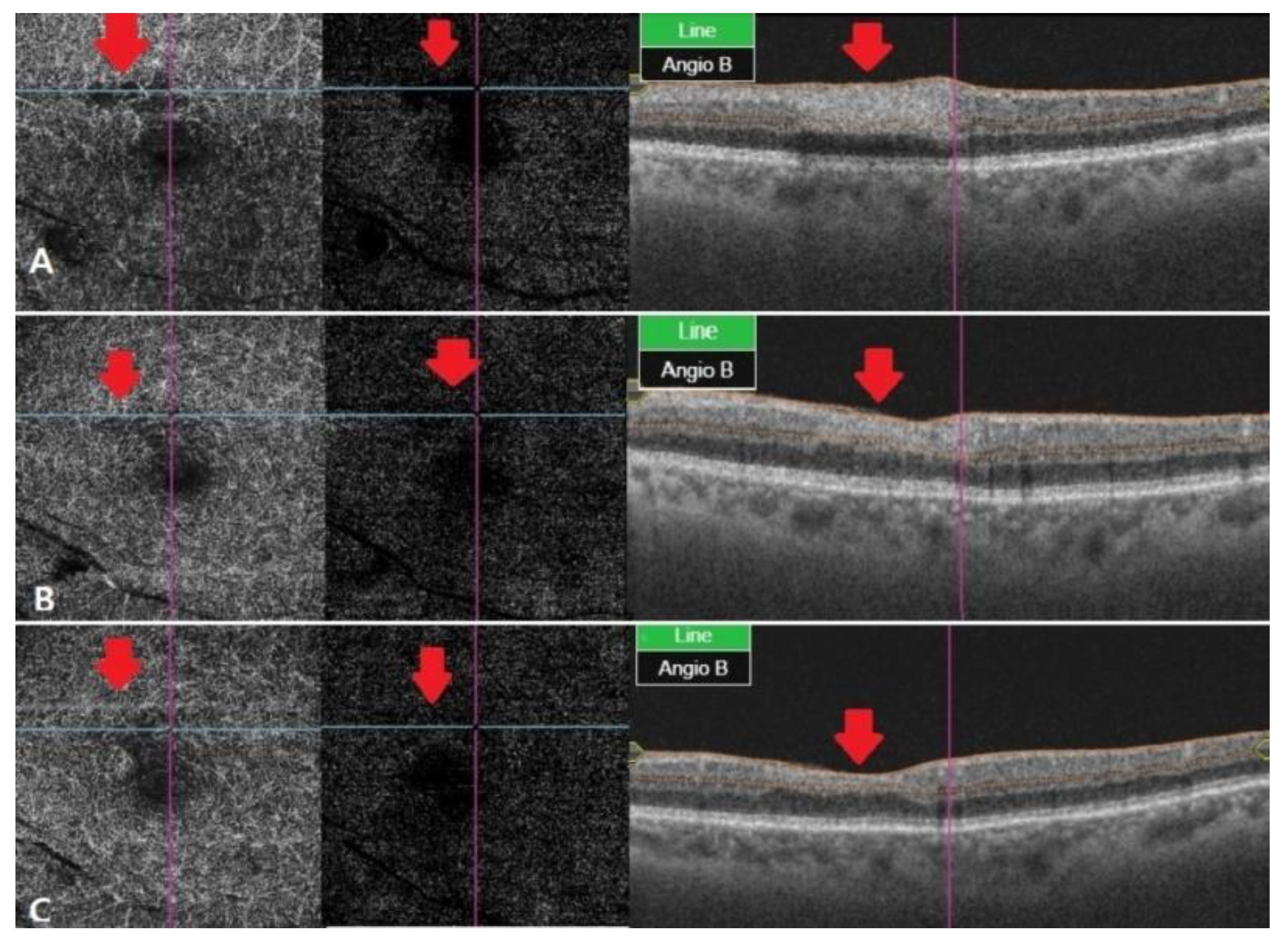 Brainsci 11 00542 g003 Brainsci 11 00542 g003