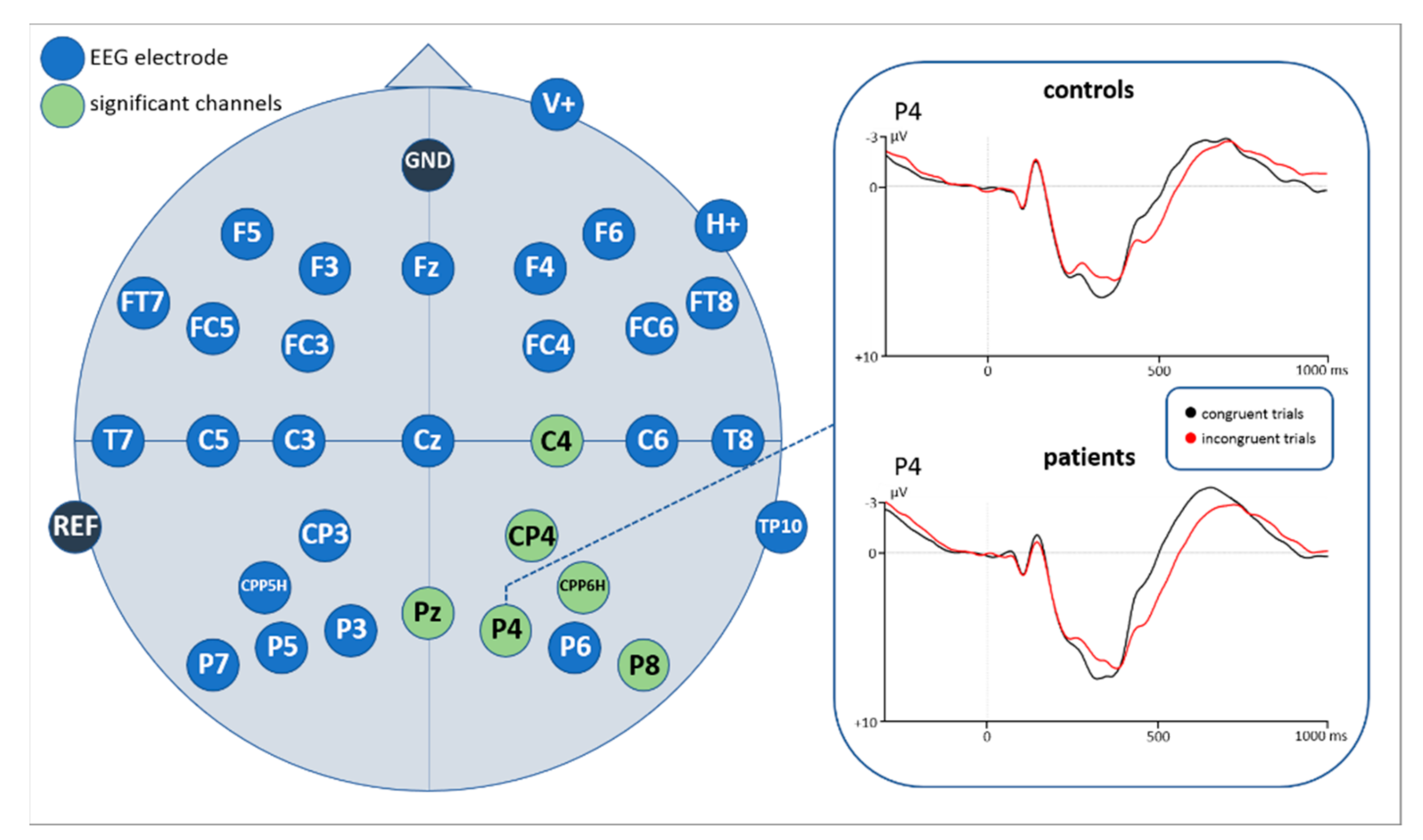 Brainsci 11 00543 g007