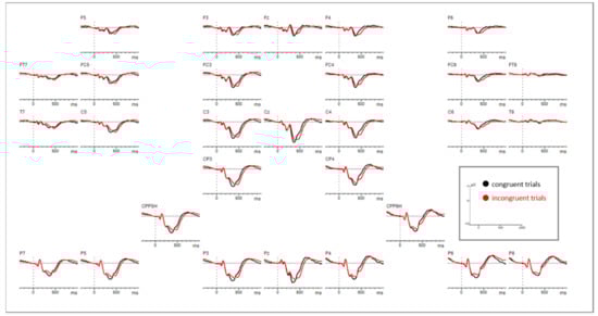 Brainsci 11 00543 g0a1