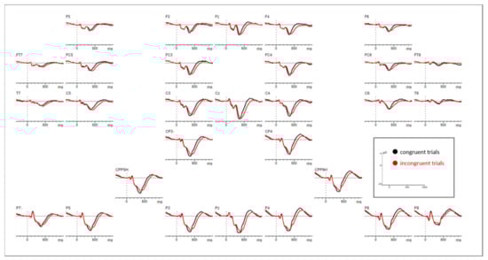 Brainsci 11 00543 g0a2
