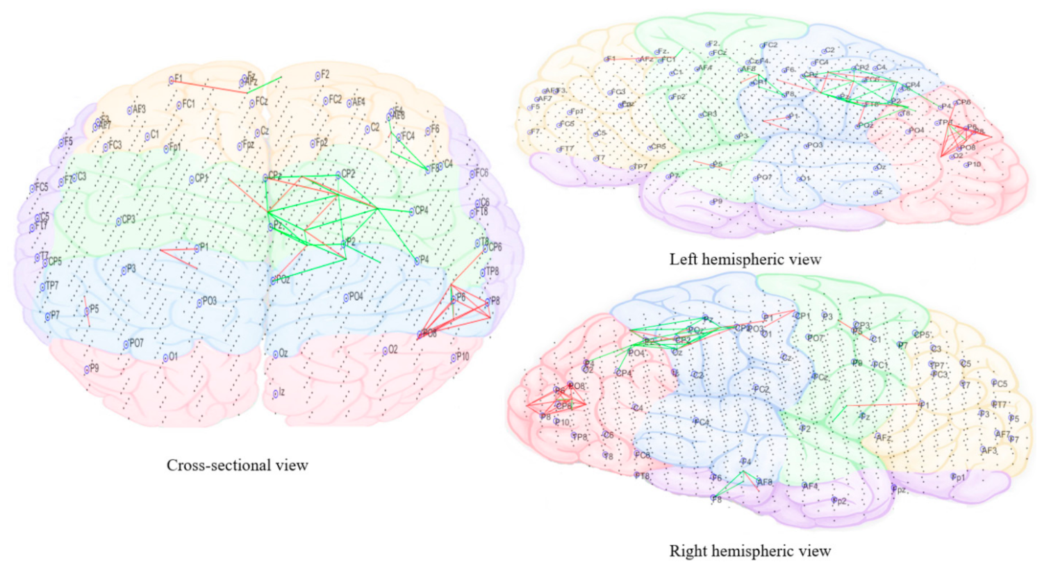 Brainsci 11 00554 g014