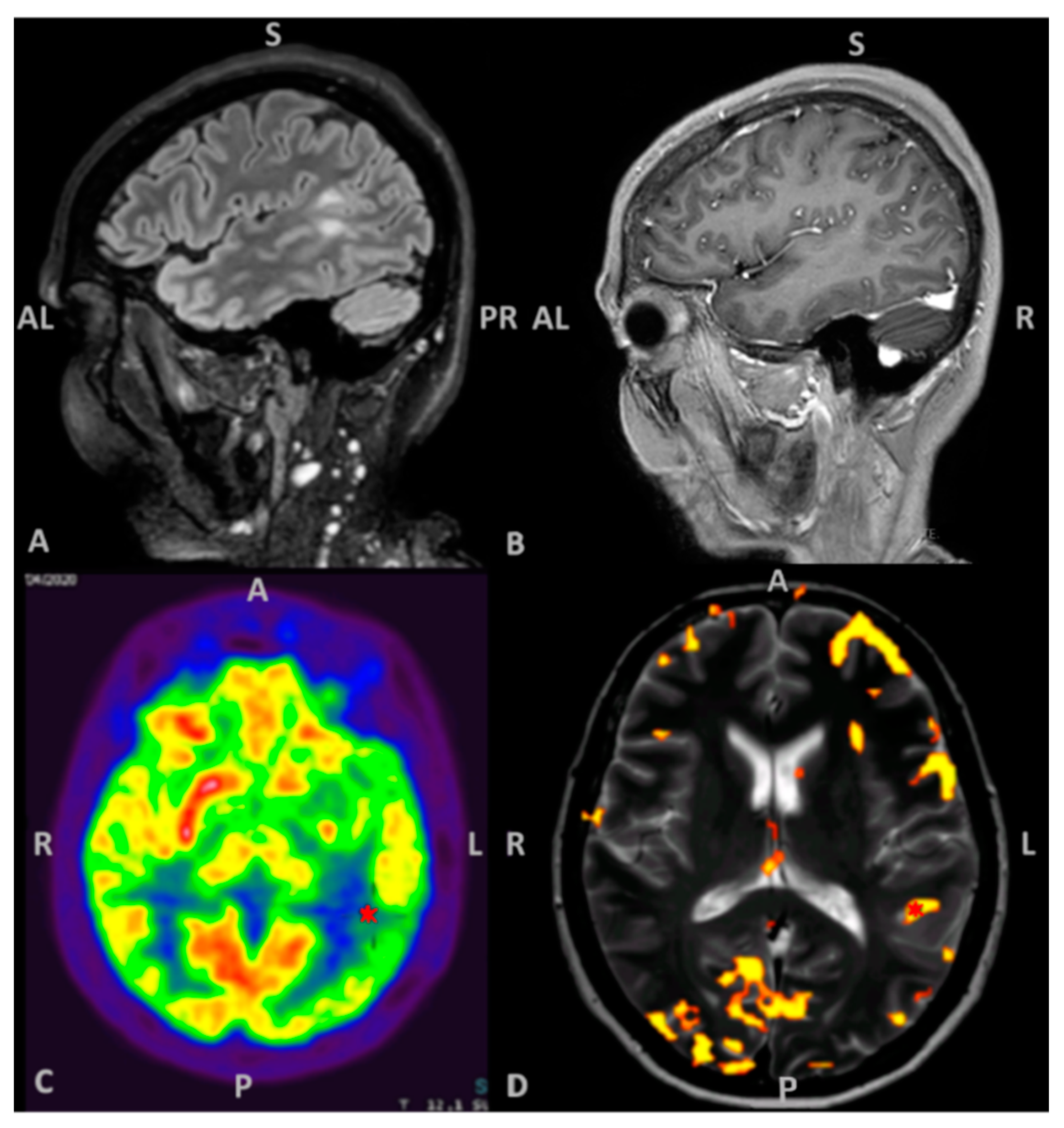 Brainsci 11 00557 g001