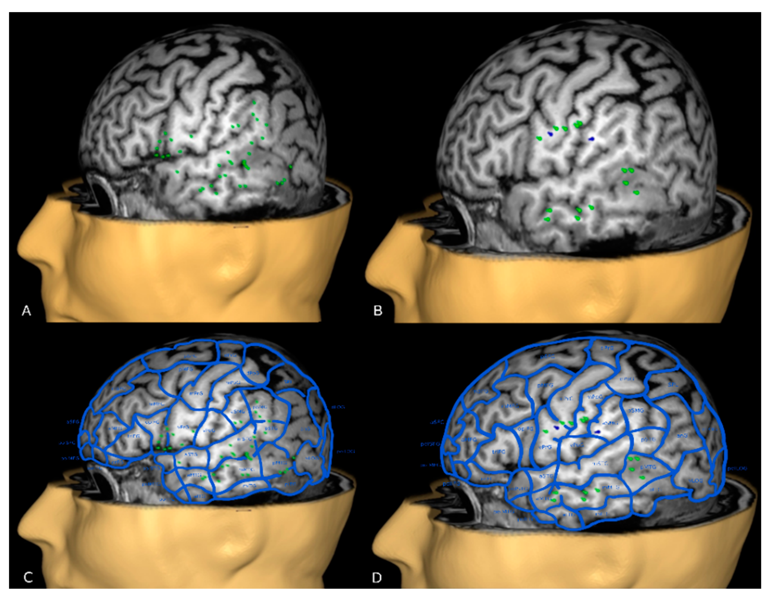 Brainsci 11 00557 g002