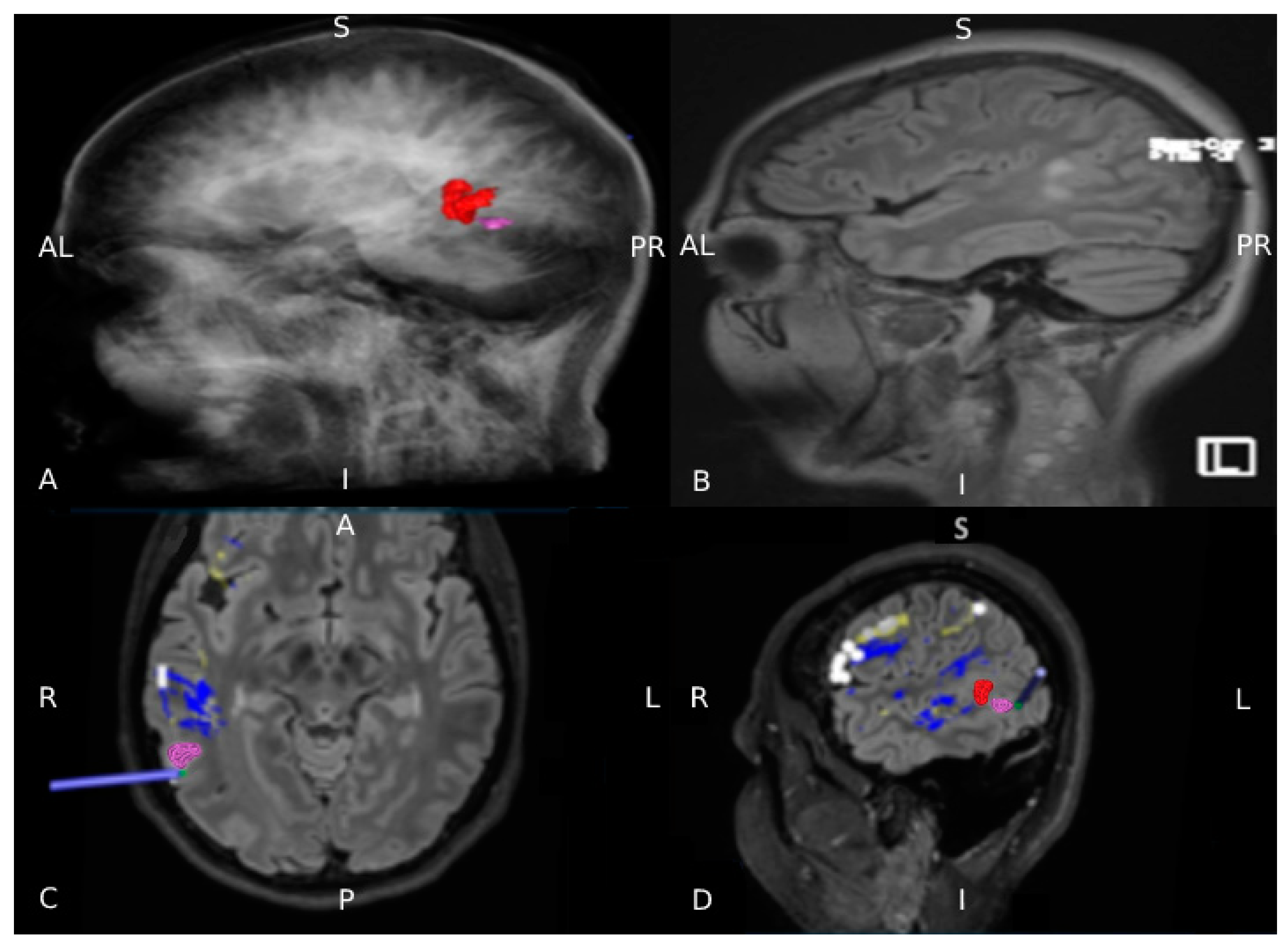 Brainsci 11 00557 g004