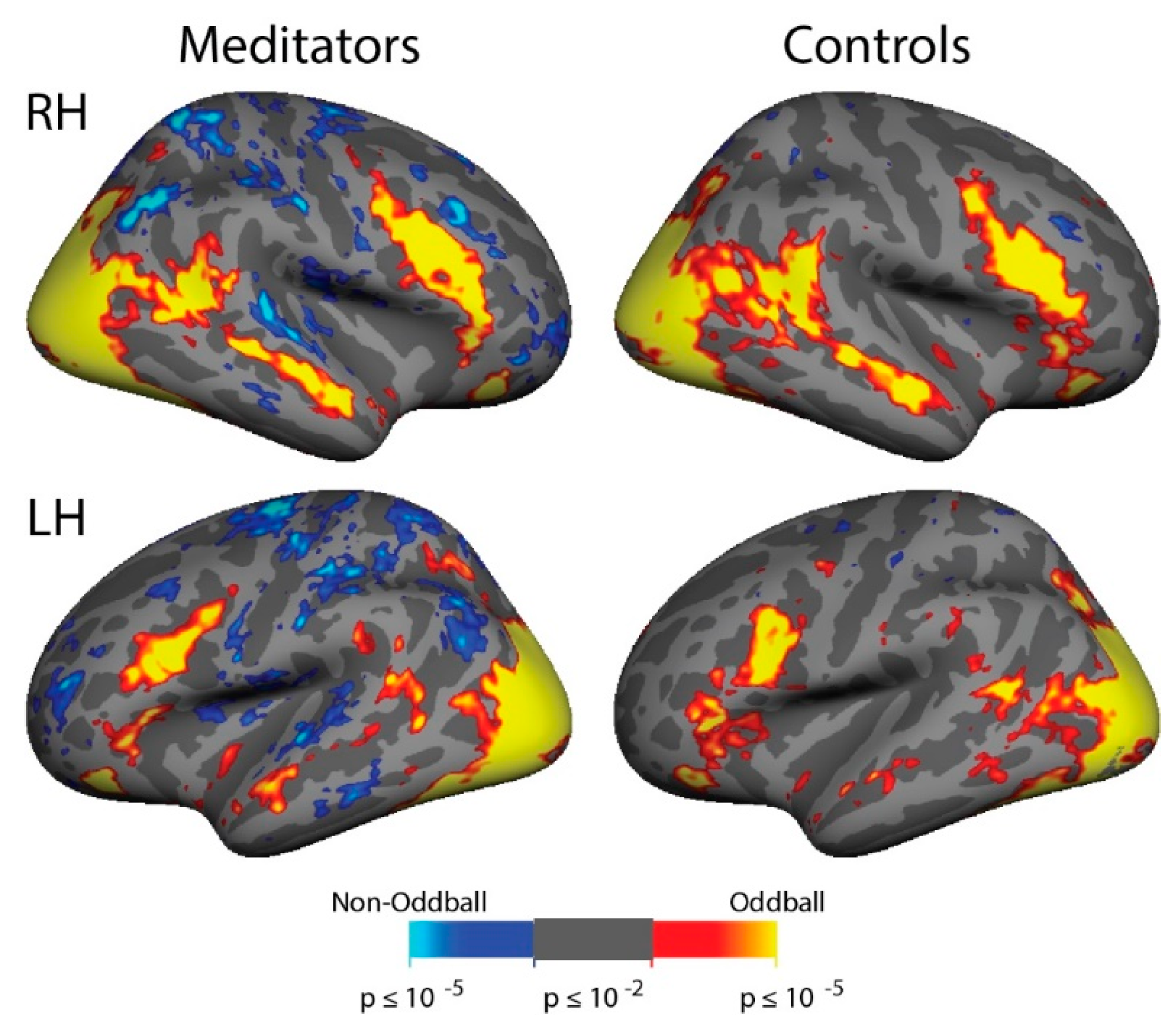 Brainsci 11 00566 g006