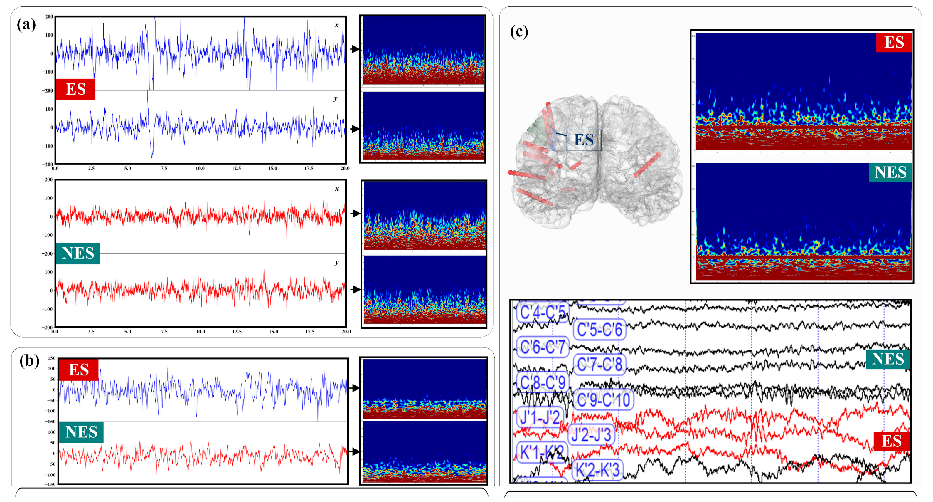 Brainsci 11 00615 g001
