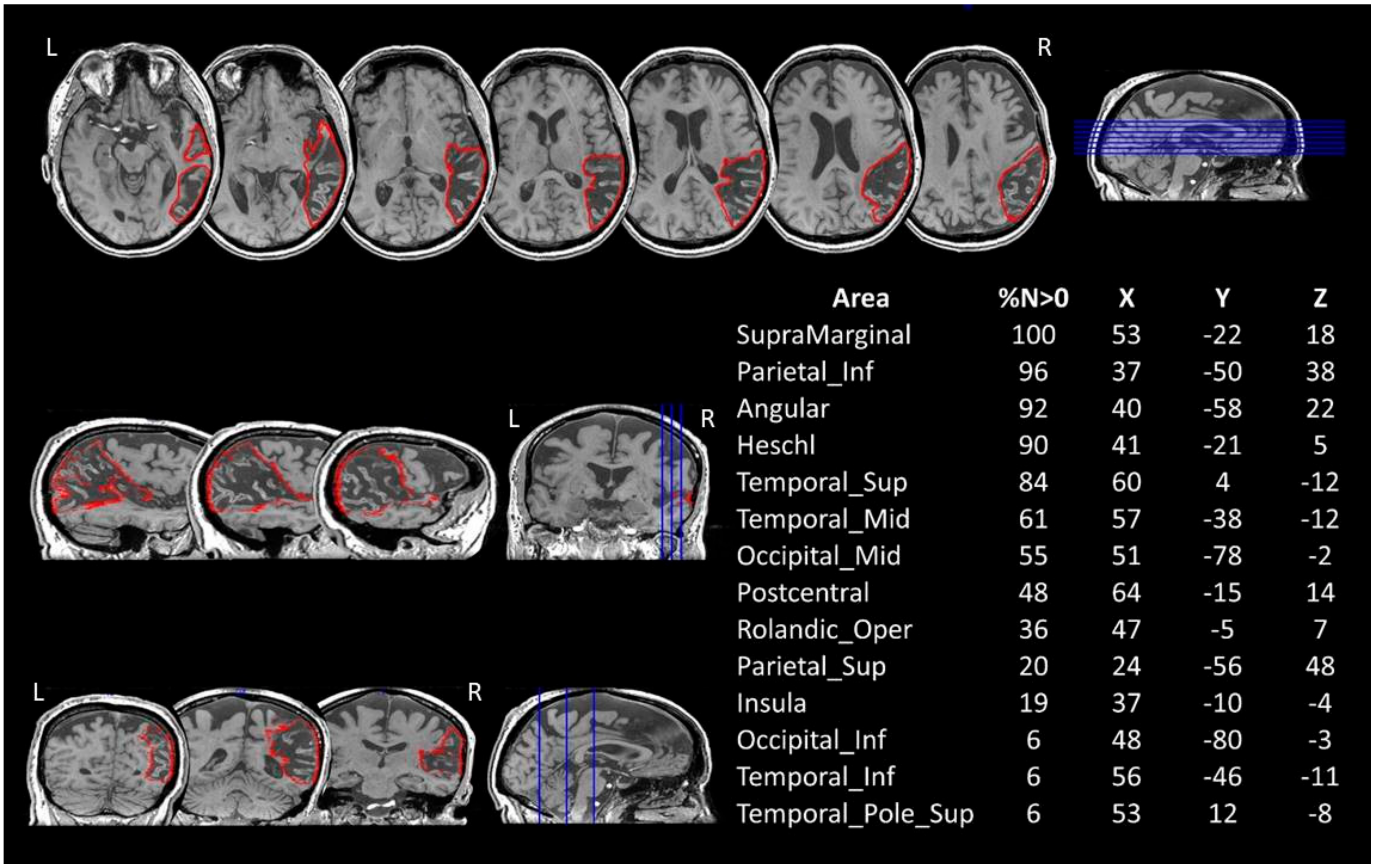 Brainsci 11 00632 g001 Brainsci 11 00632 g001