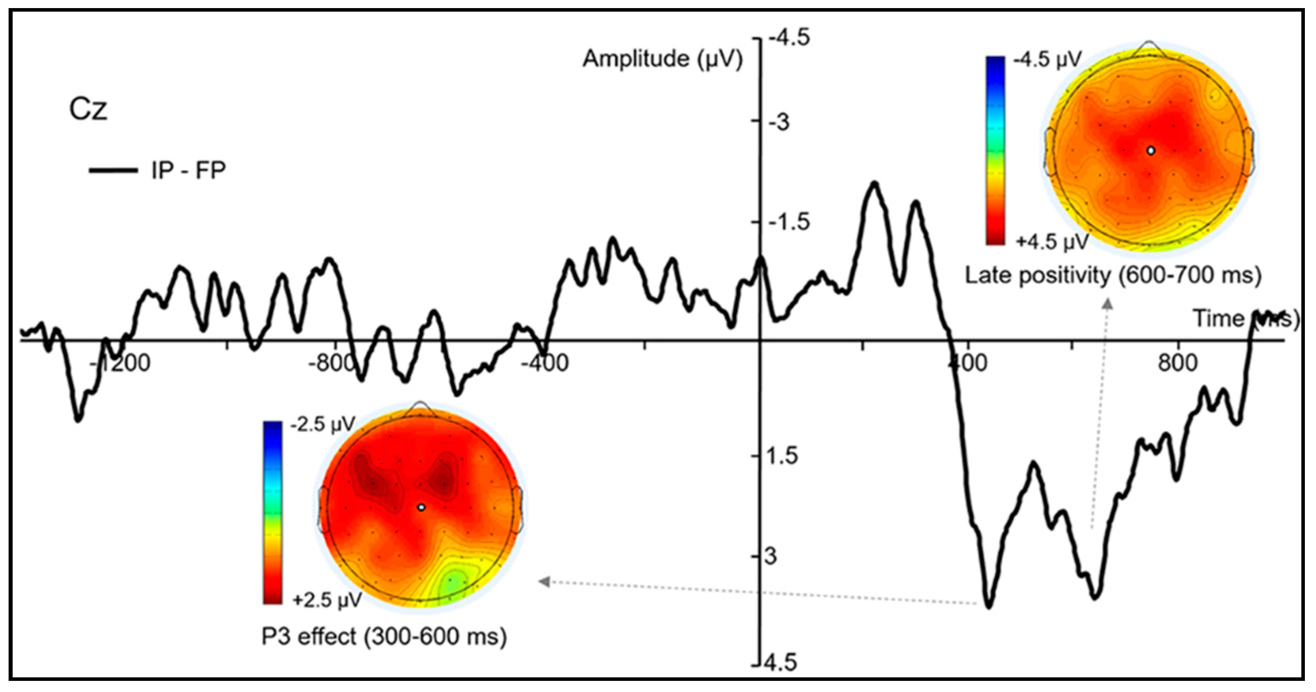 Brainsci 11 00641 g005 Brainsci 11 00641 g005