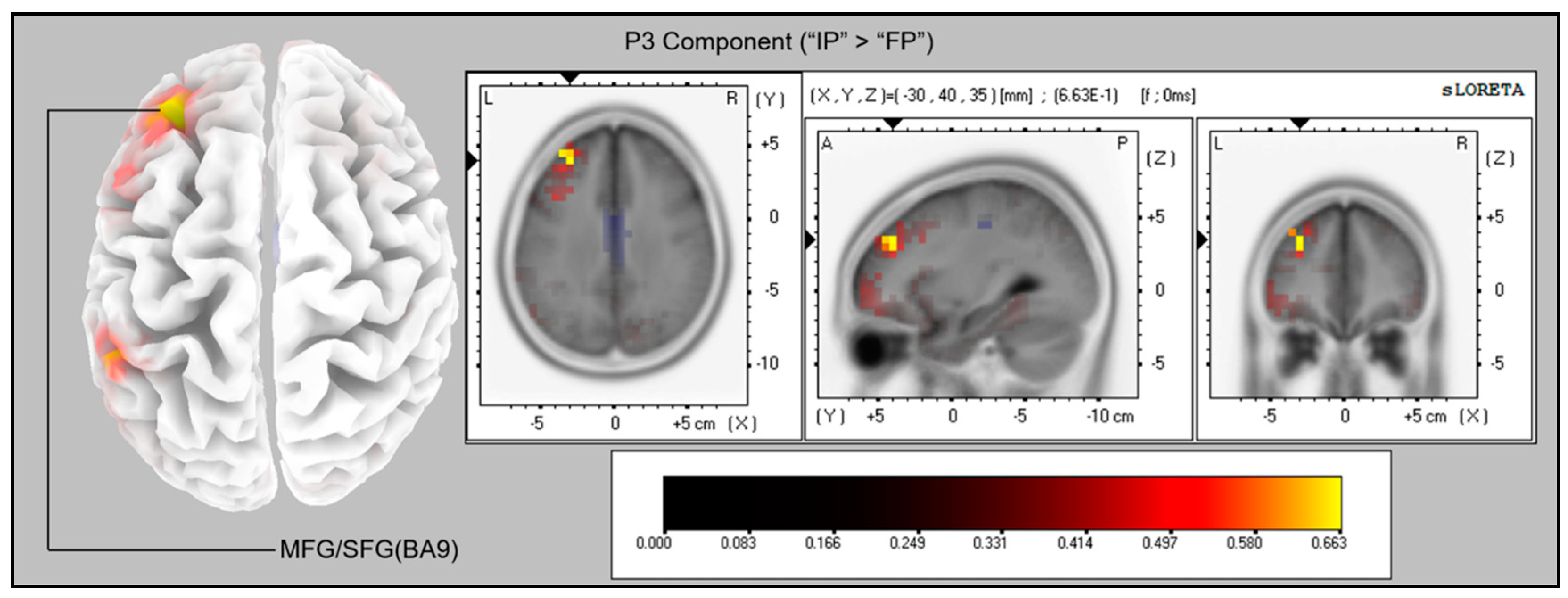 Brainsci 11 00641 g007 Brainsci 11 00641 g007