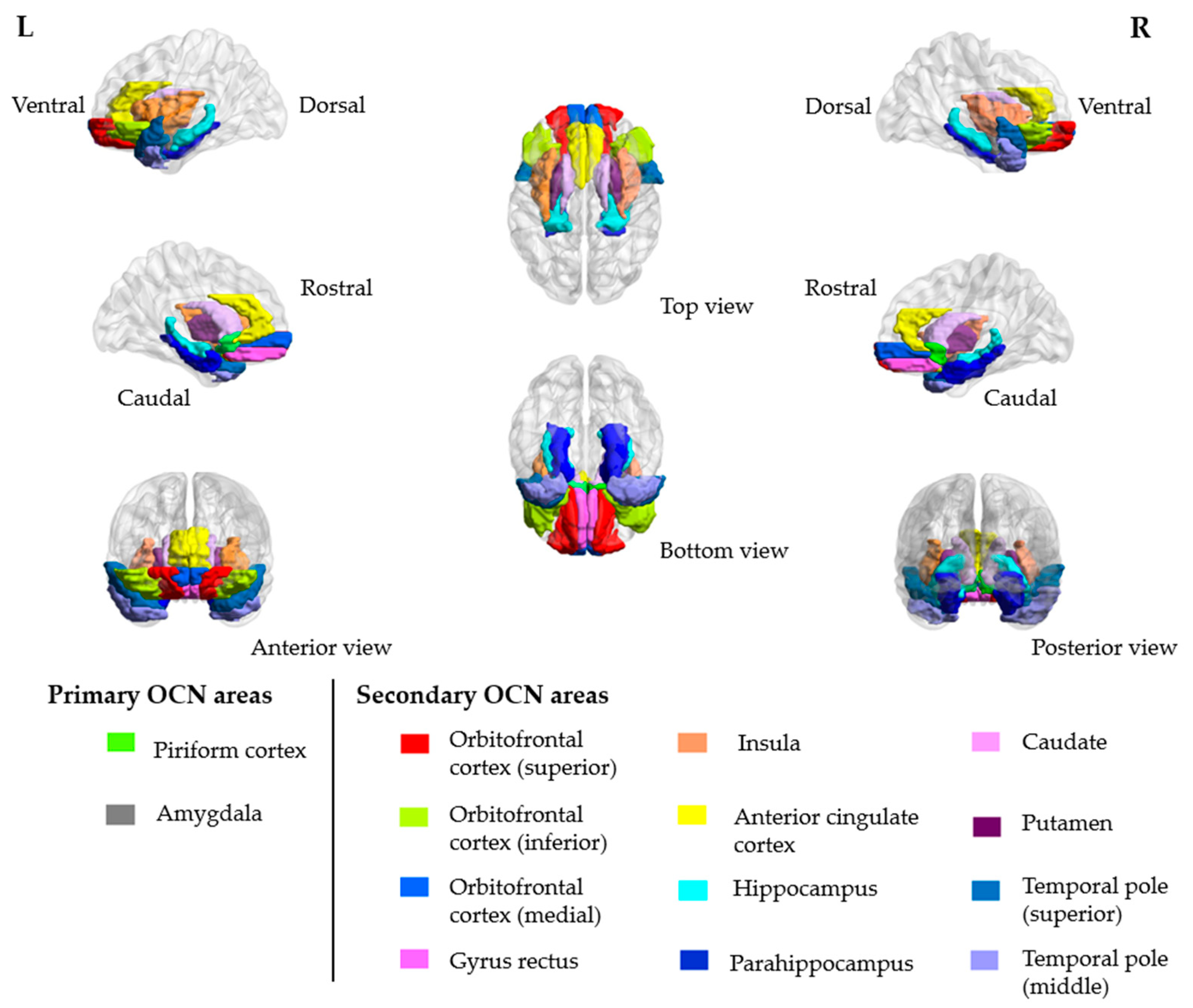 Brainsci 11 00686 g001 Brainsci 11 00686 g001