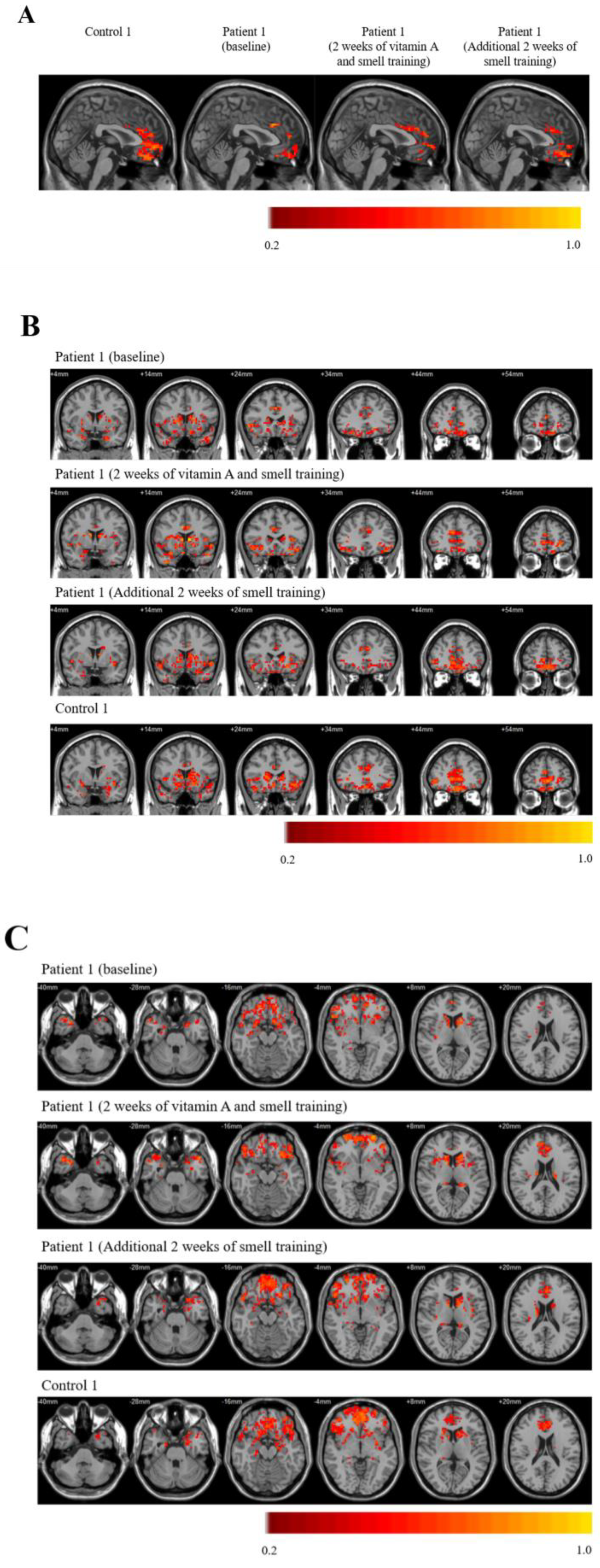 Brainsci 11 00686 g002 Brainsci 11 00686 g002
