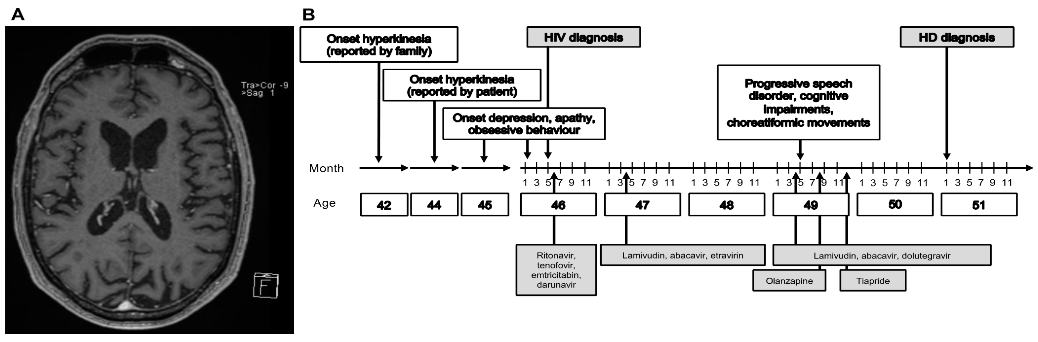 Brainsci 11 00710 g001