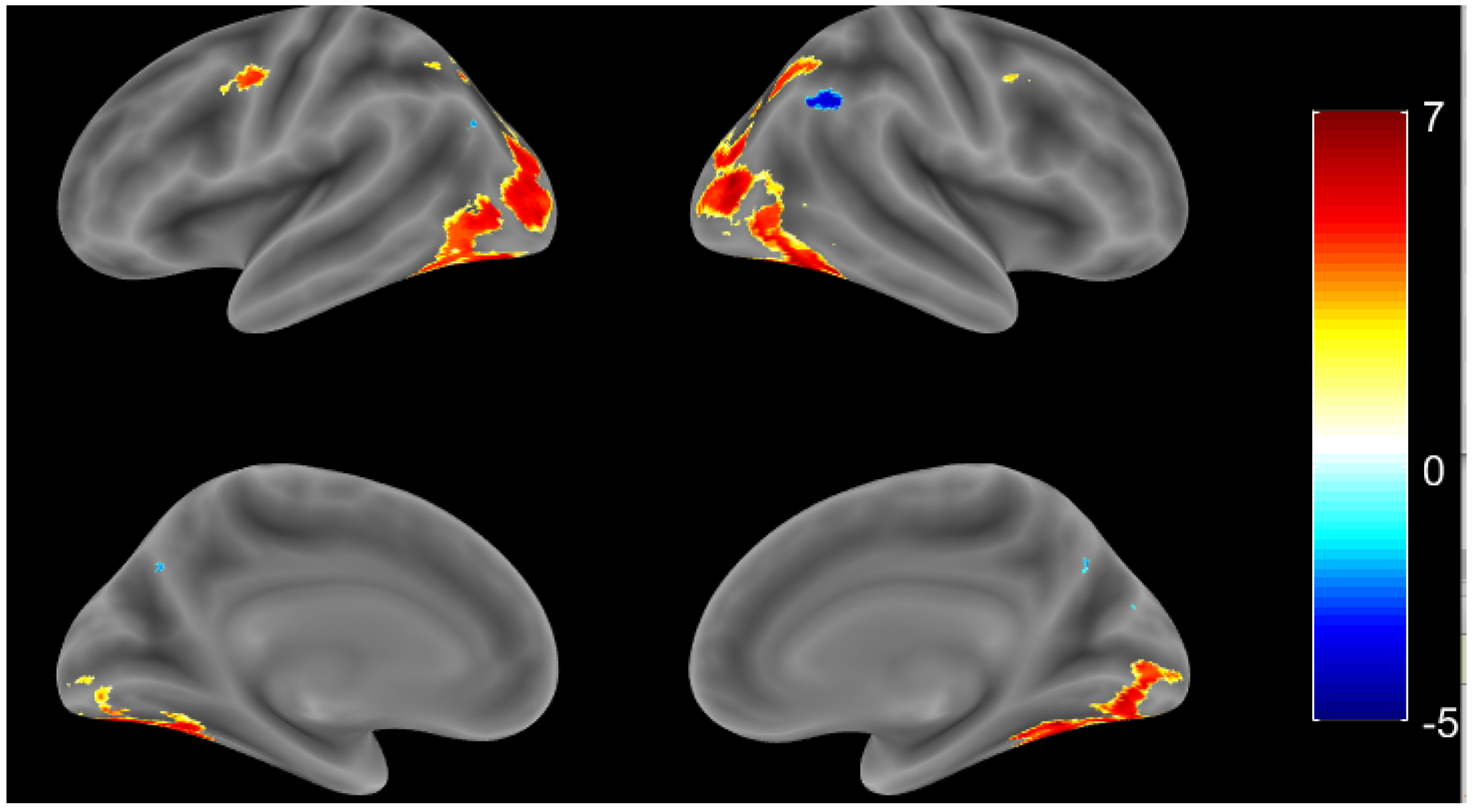 Brainsci 11 00718 g003