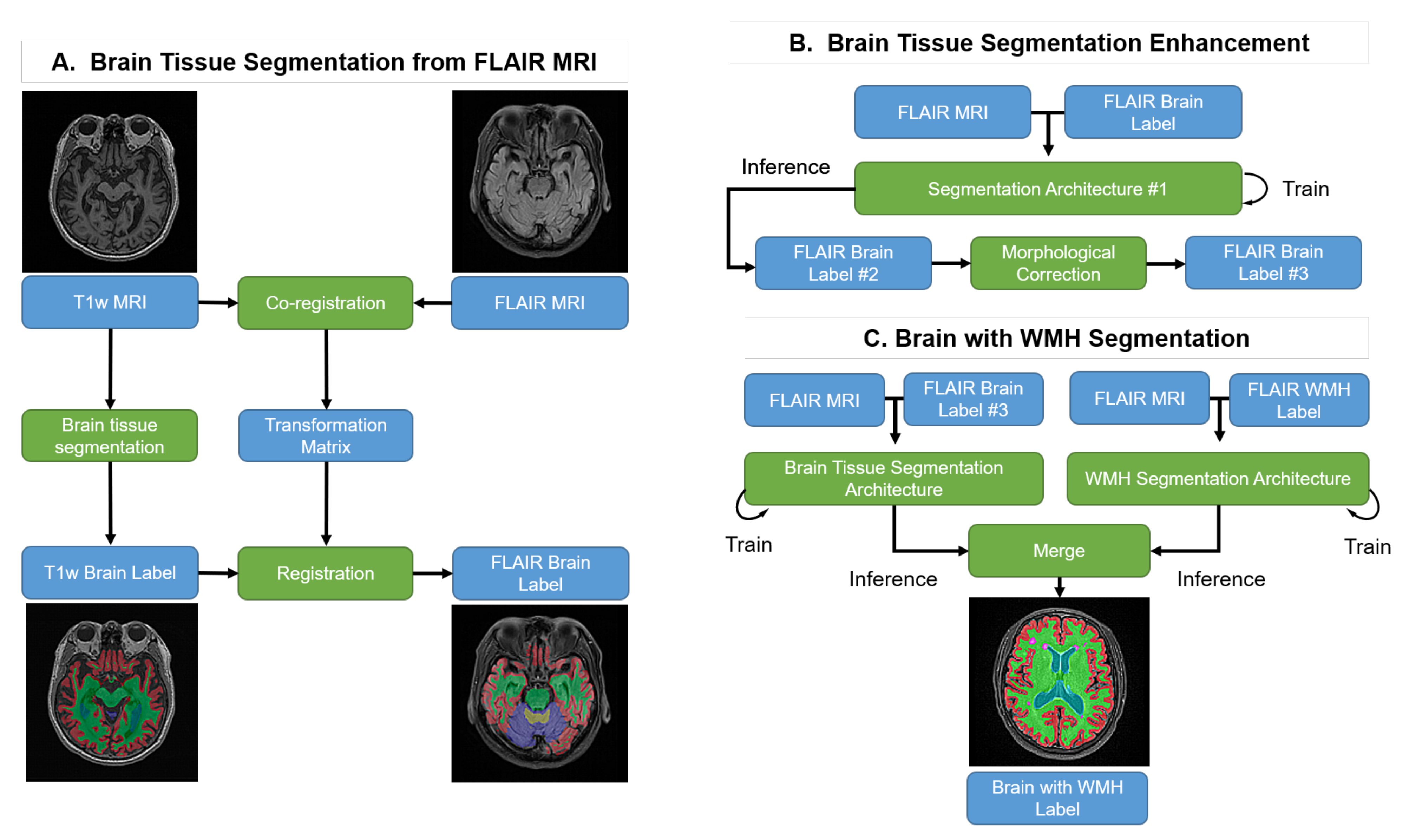 Brainsci 11 00720 g001