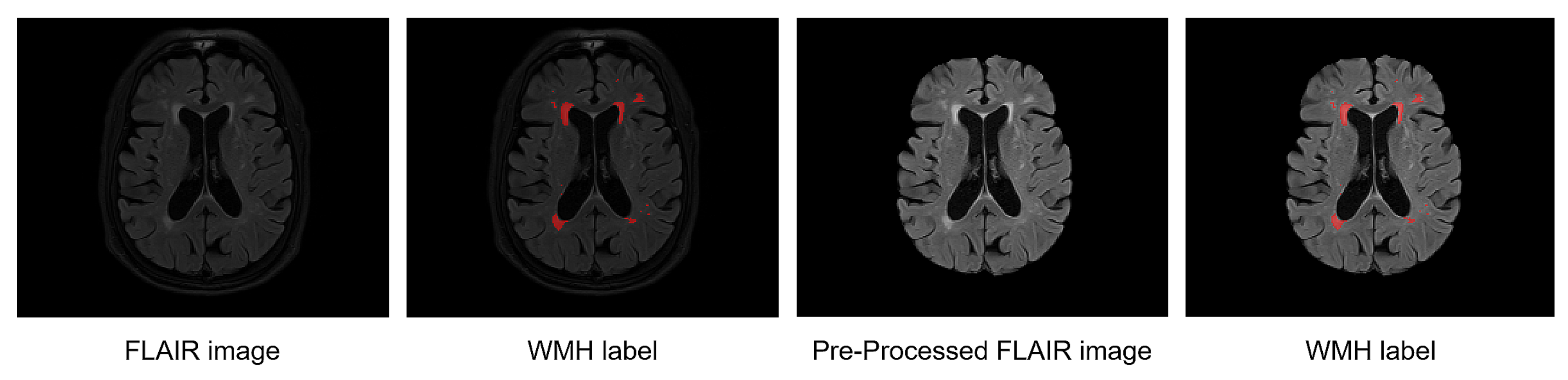 Brainsci 11 00720 g003