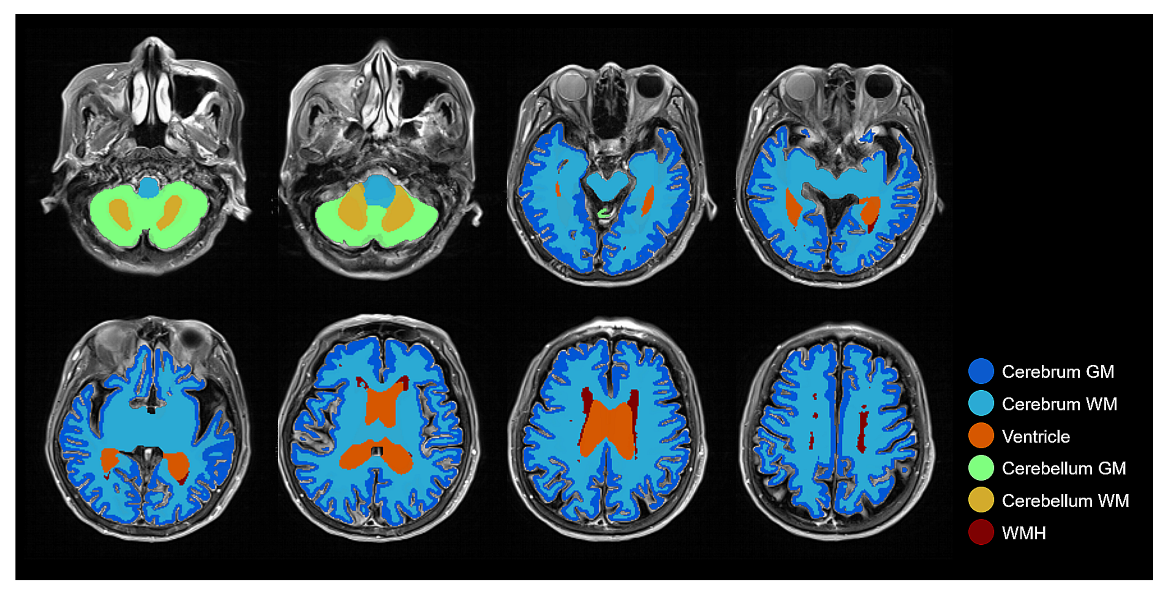 Brainsci 11 00720 g007