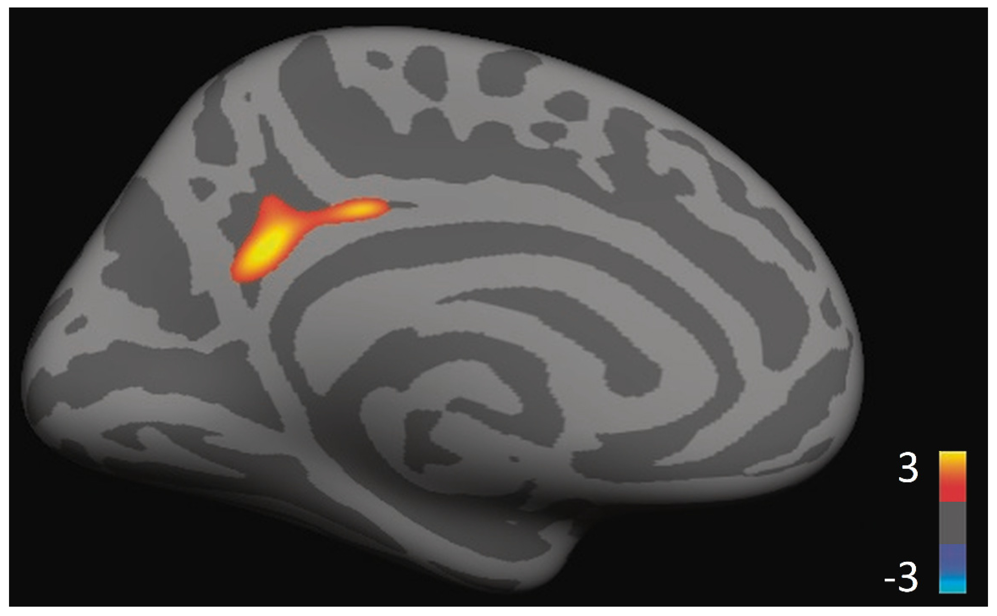 Brainsci 11 00728 g002