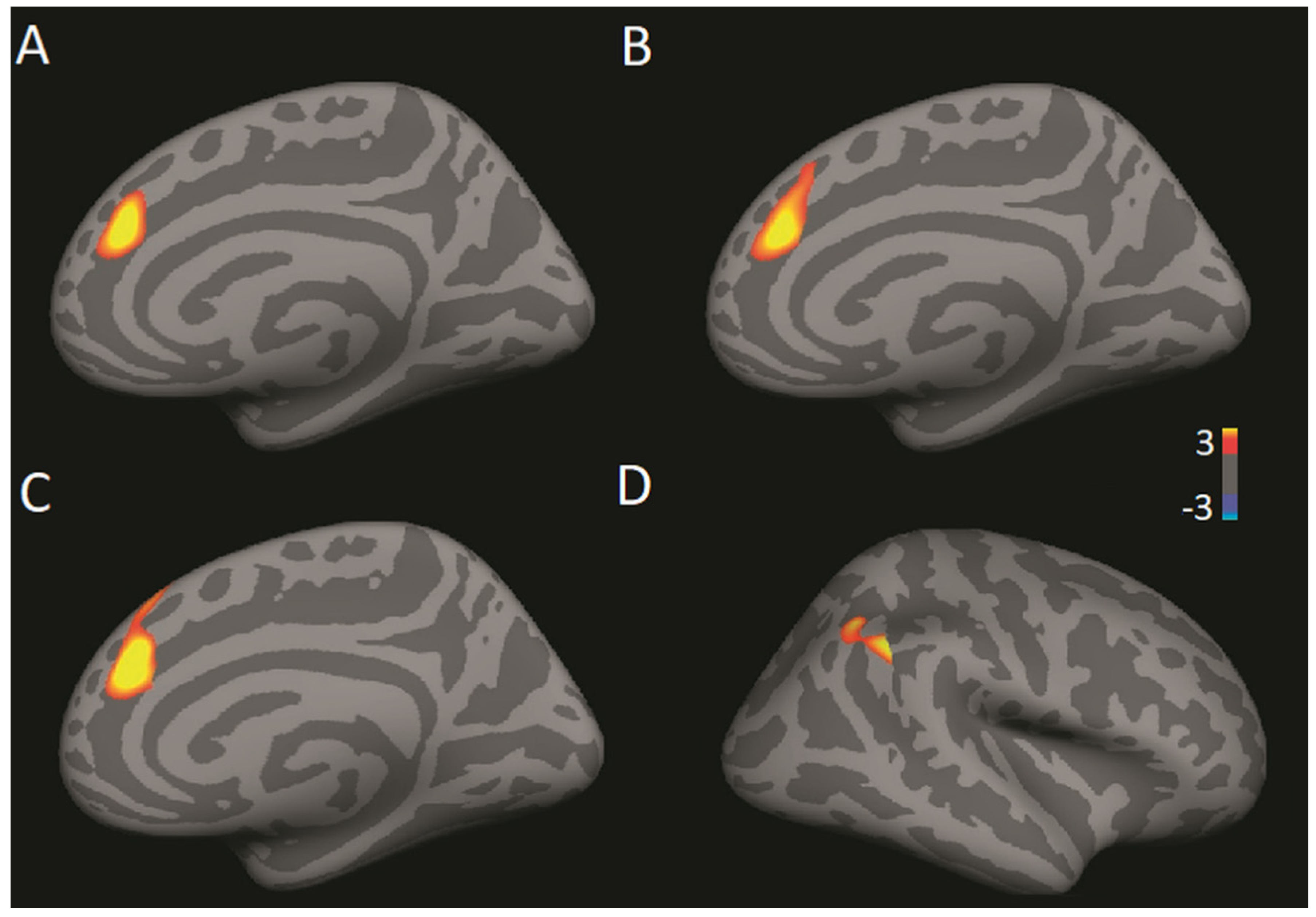 Brainsci 11 00728 g004