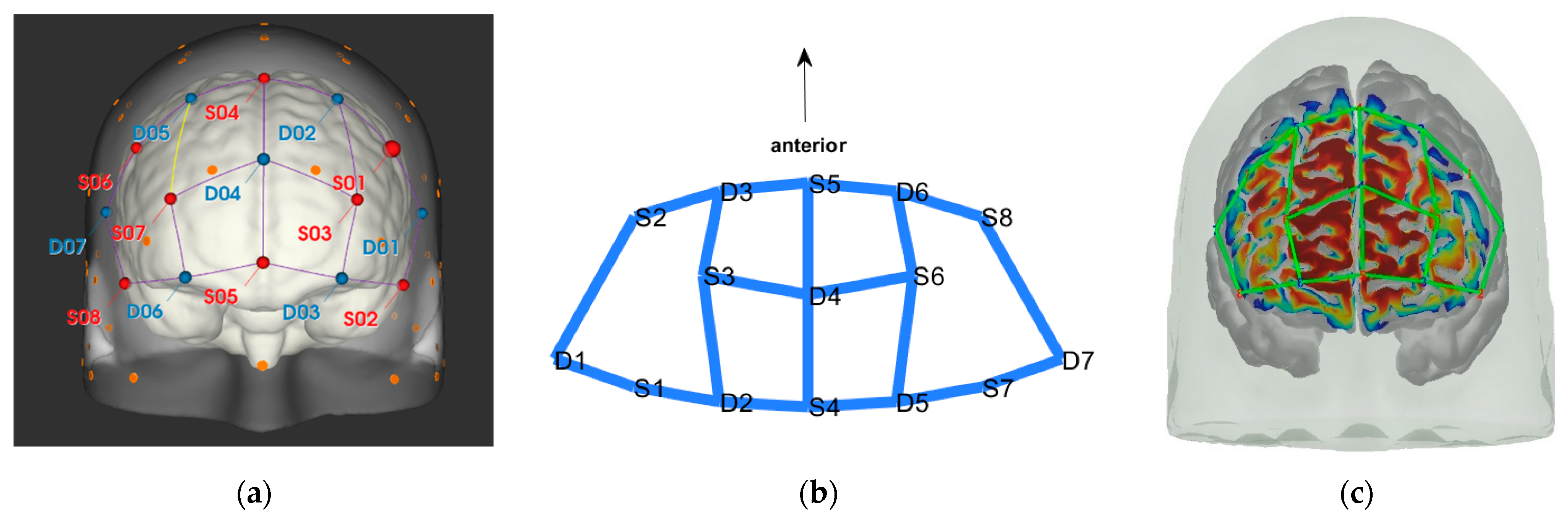 Brainsci 11 00742 g001