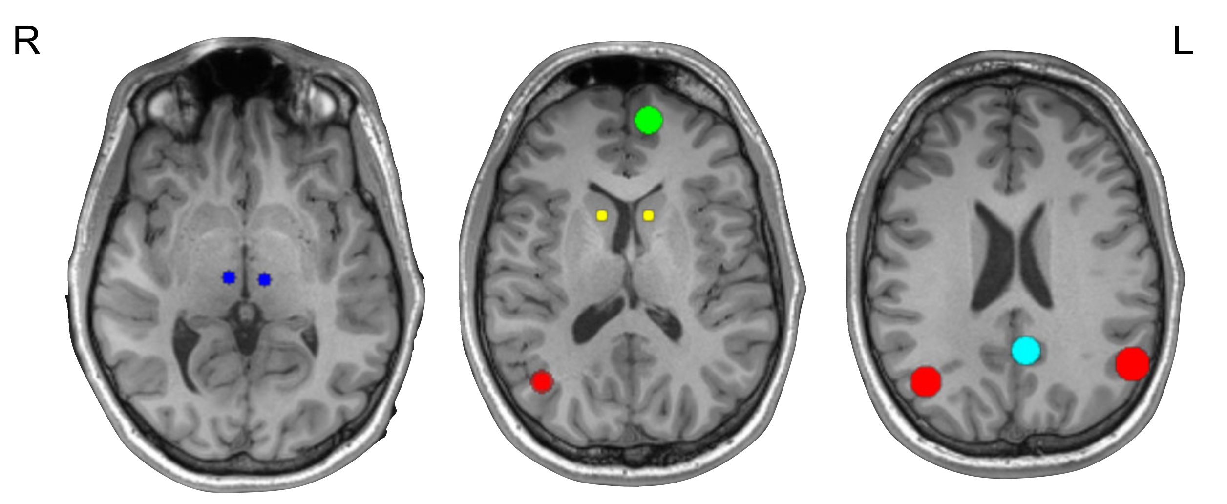 Brainsci 11 00749 g001