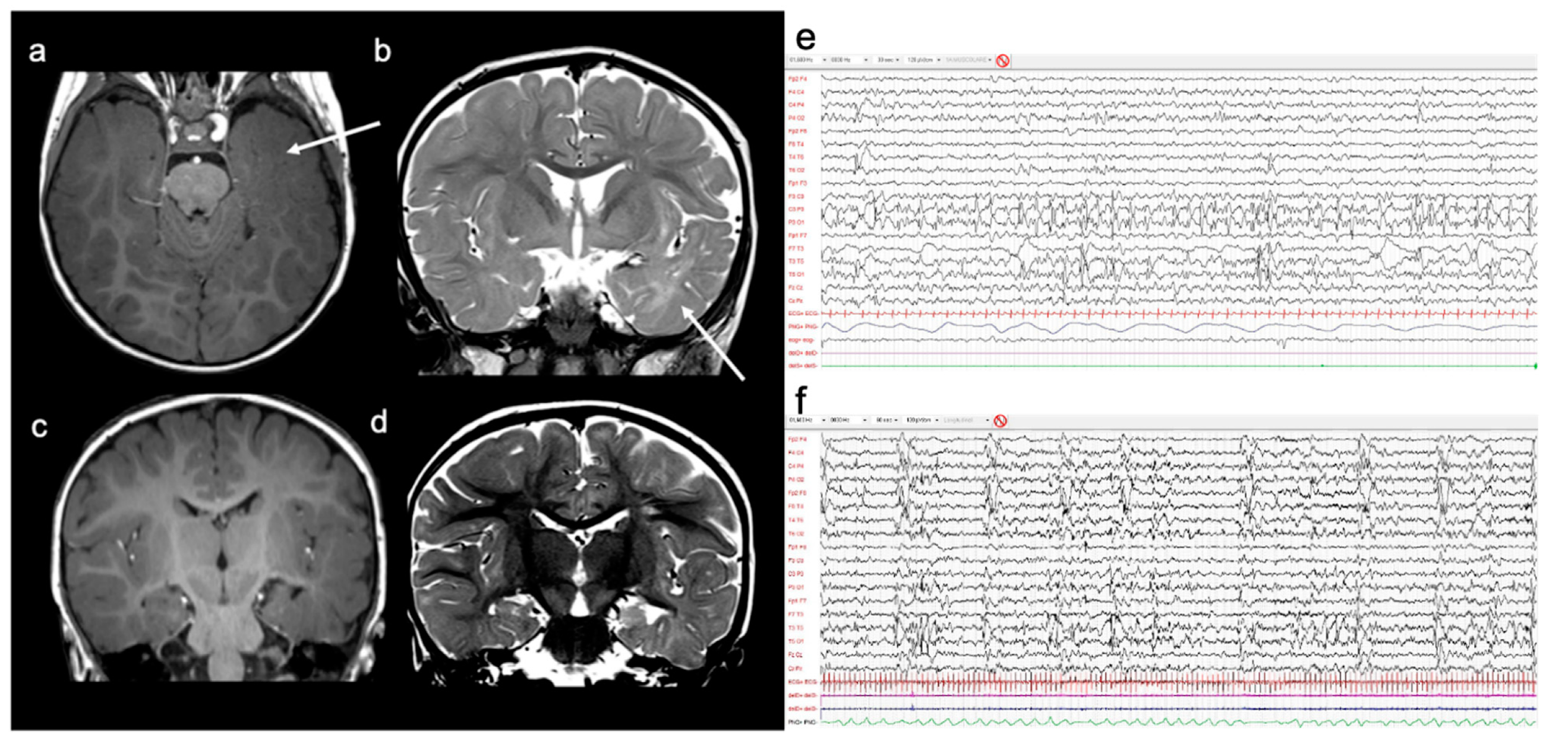 Brainsci 11 00793 g002