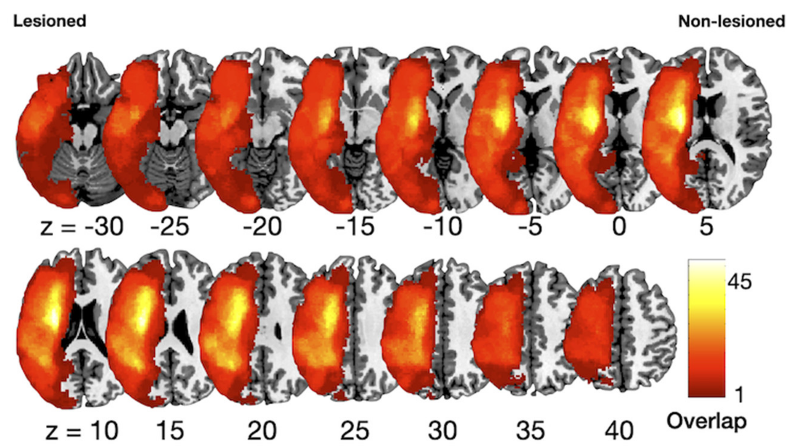 Brainsci 11 00870 g001