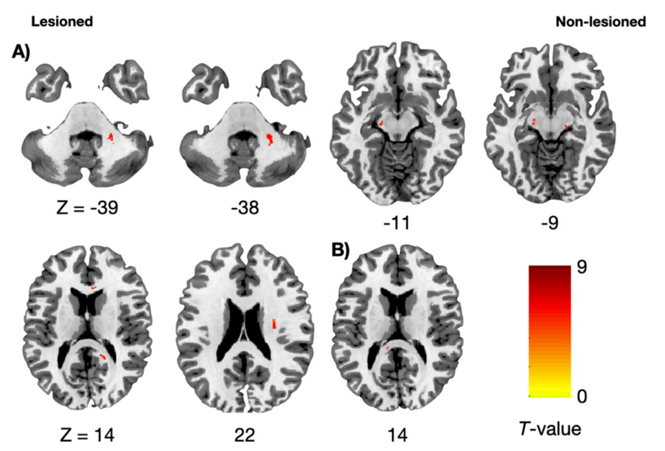 Brainsci 11 00870 g002