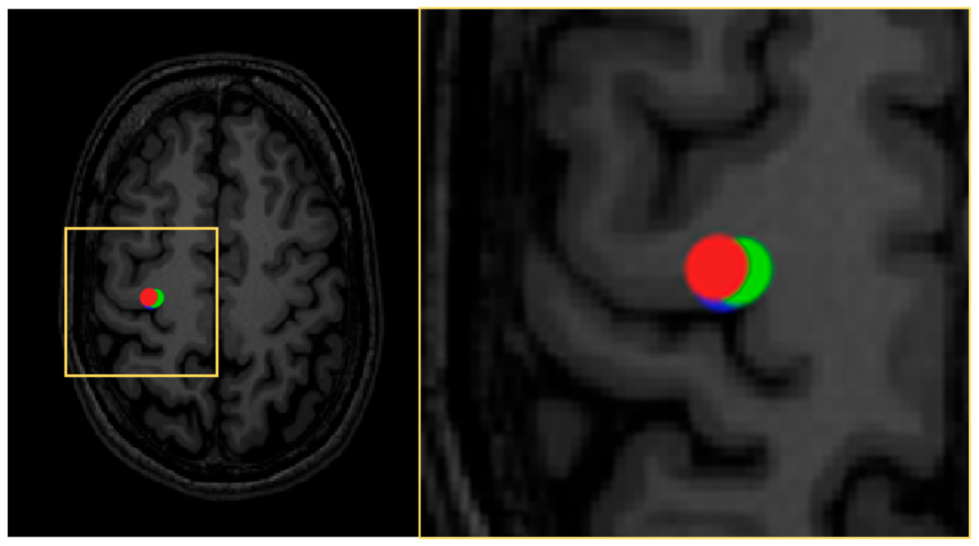 Brainsci 11 00897 g011 Brainsci 11 00897 g011