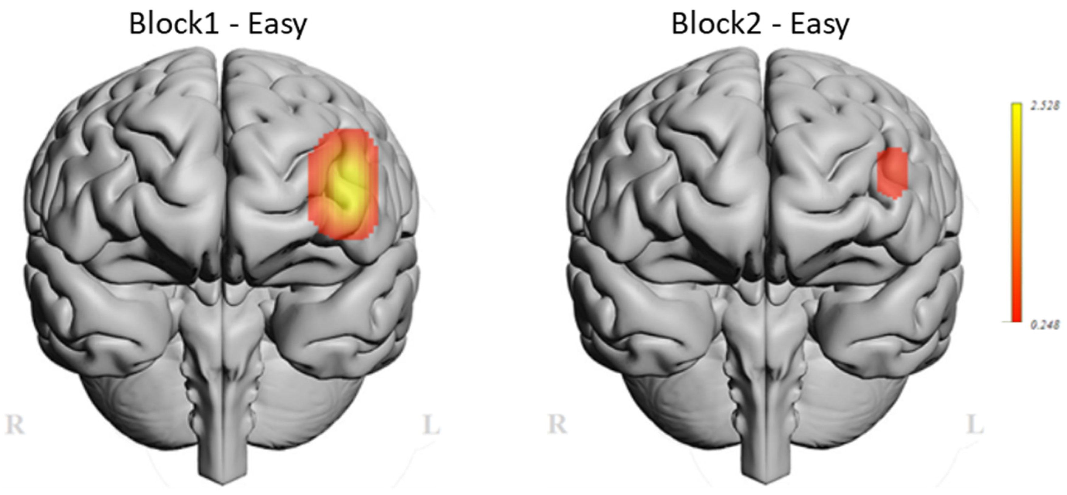 Brainsci 11 00937 g006 Brainsci 11 00937 g006