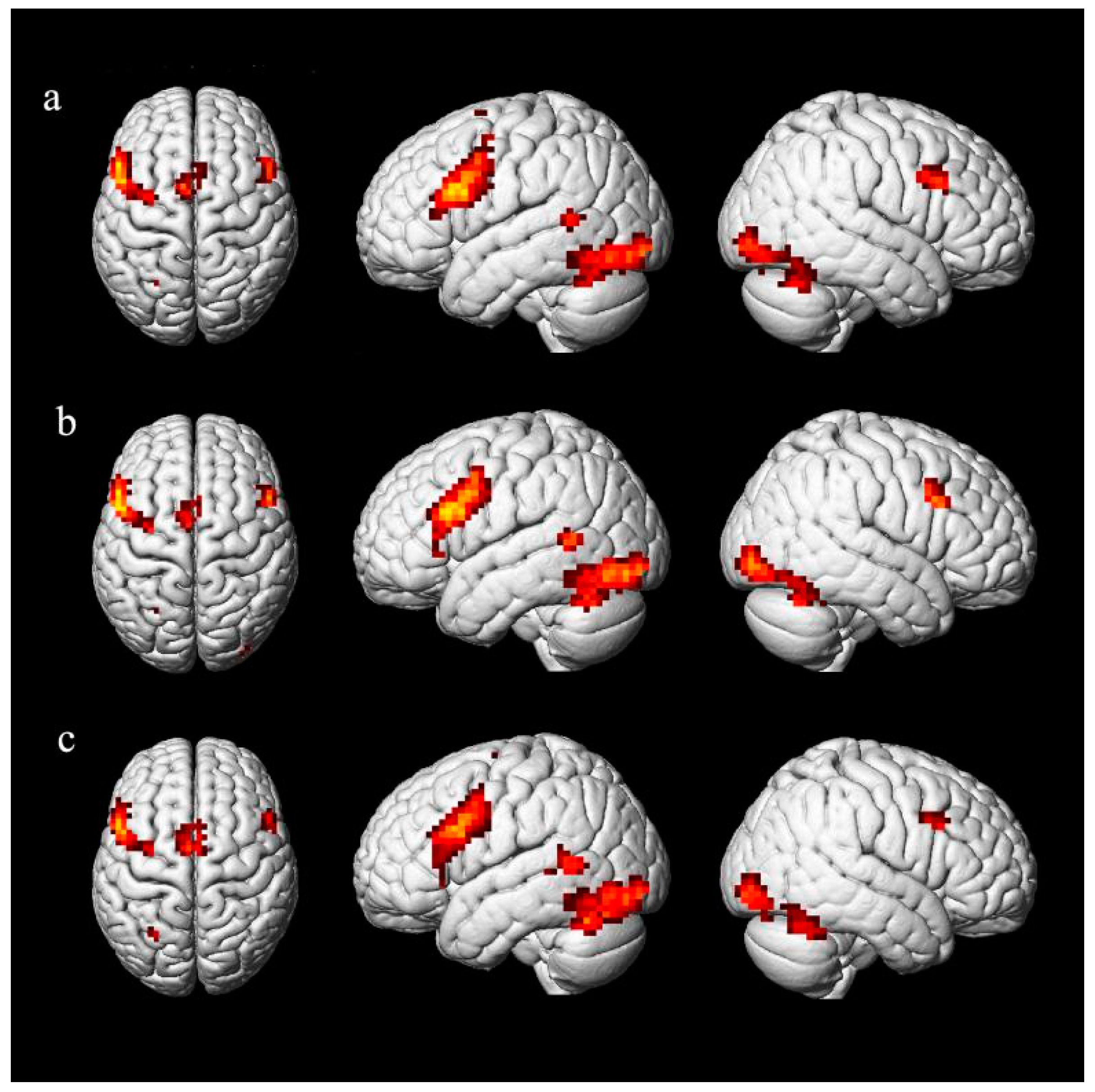 Brainsci 11 00983 g006