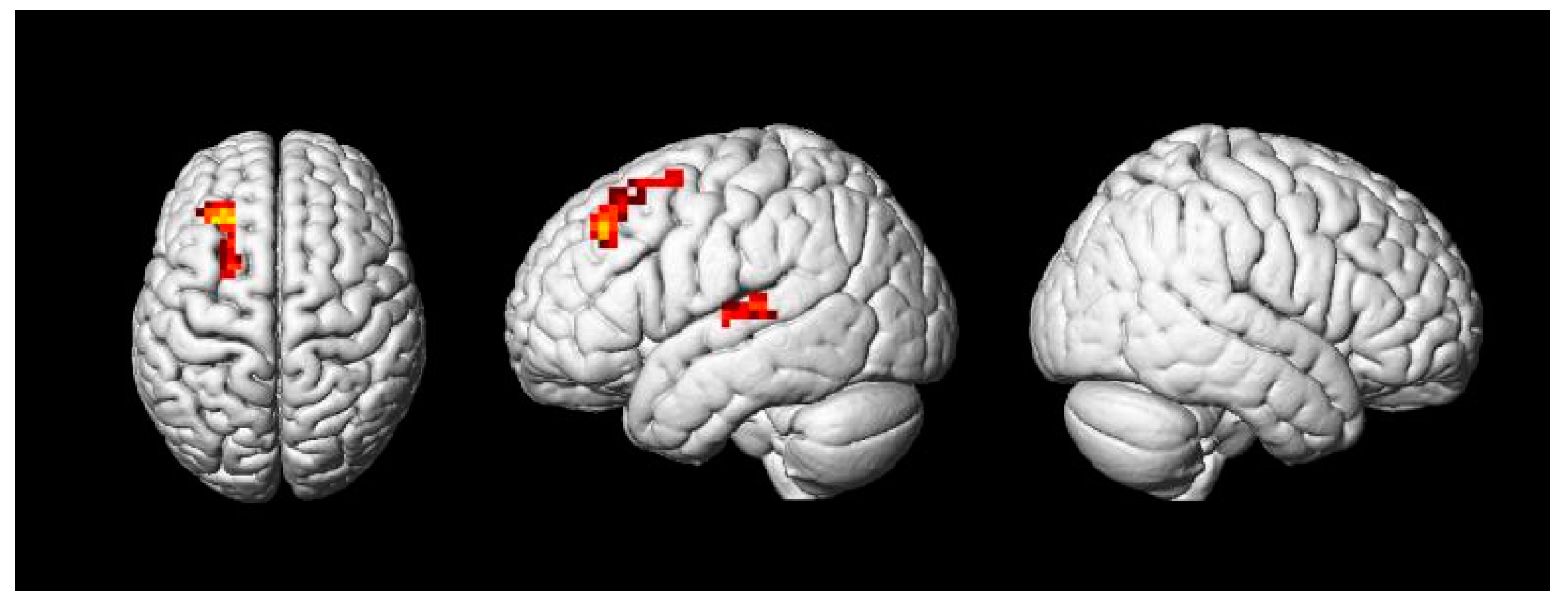 Brainsci 11 00983 g007