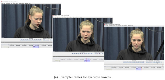 Brainsci 11 01017 g0a2a