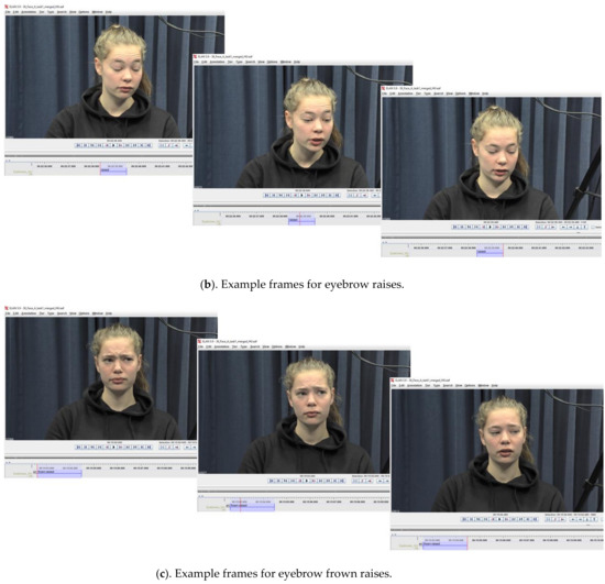 Brainsci 11 01017 g0a2b