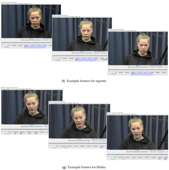 Brainsci 11 01017 g0a2d