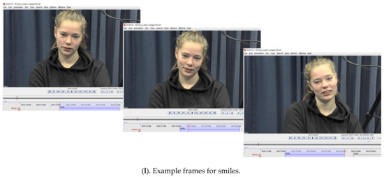 Brainsci 11 01017 g0a2g