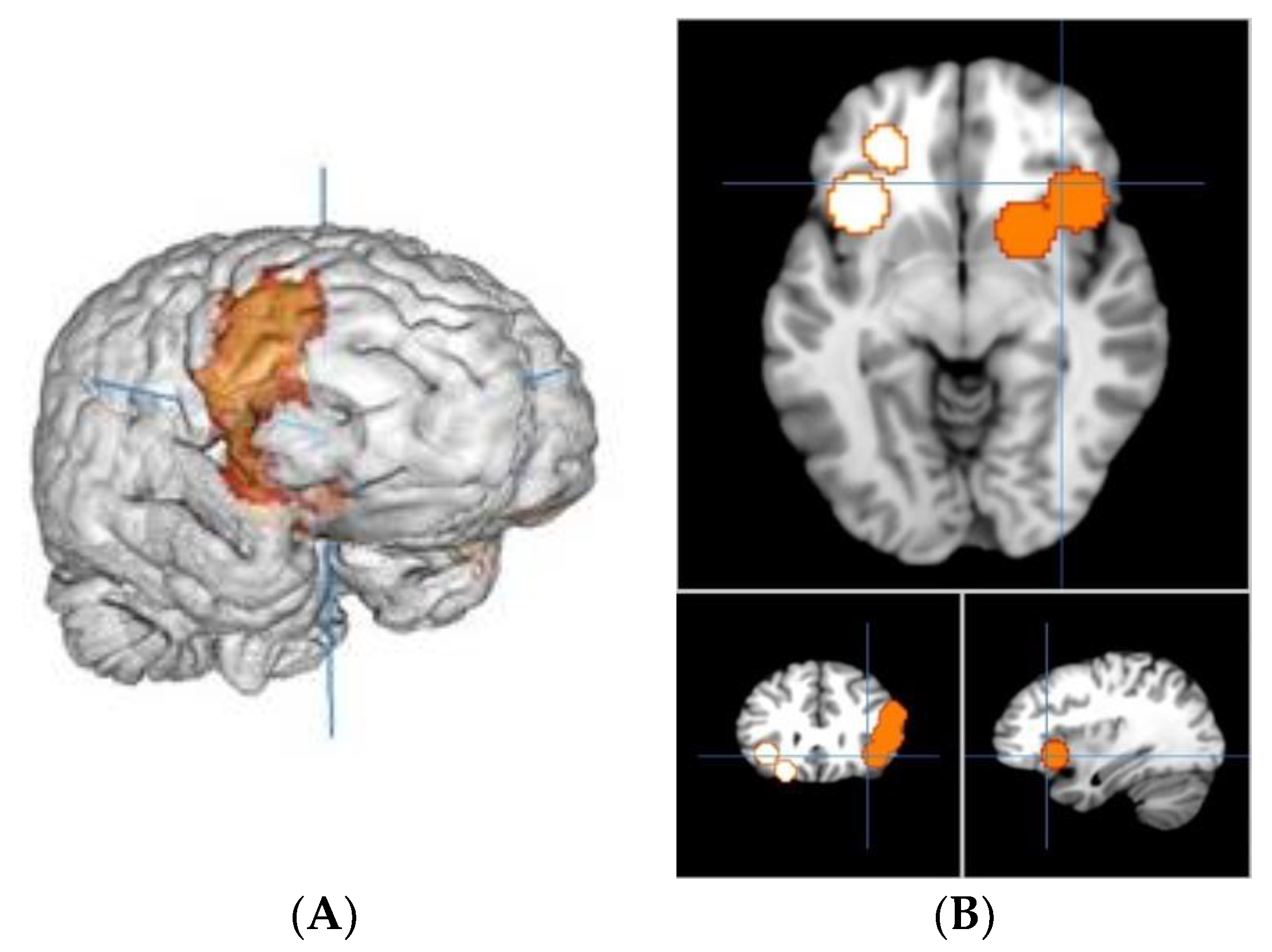 Brainsci 11 01043 g002
