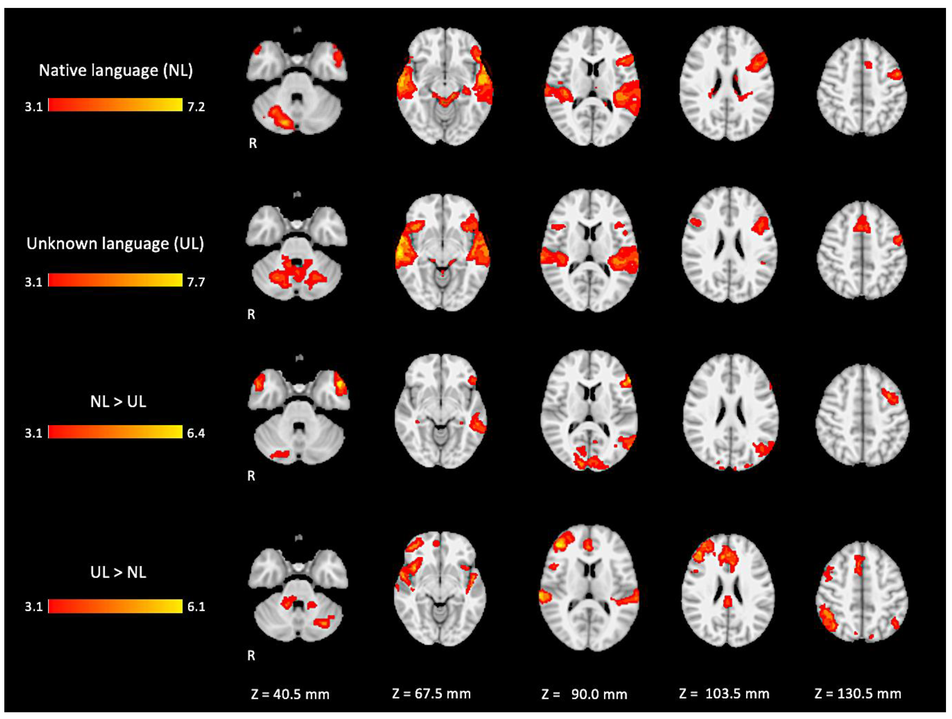 Brainsci 11 01063 g005