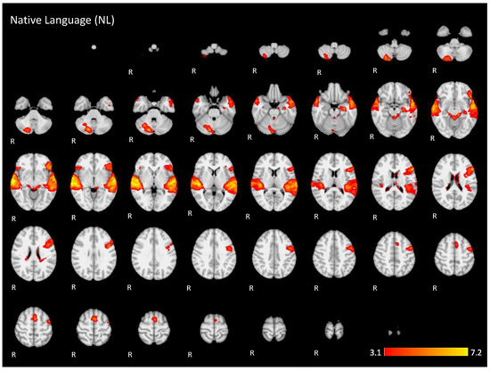 Brainsci 11 01063 g0a1 550