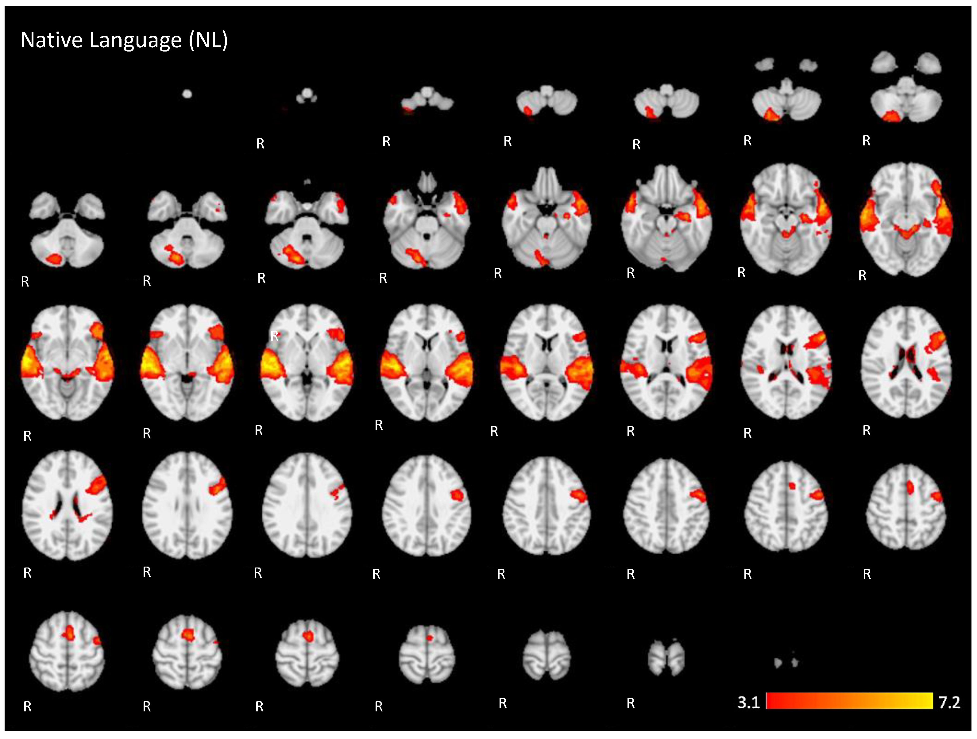 Brainsci 11 01063 g0a1