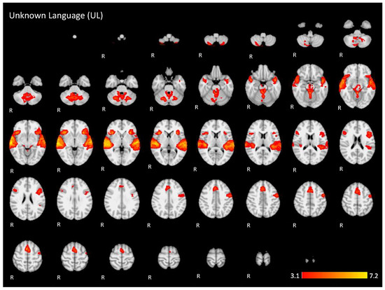 Brainsci 11 01063 g0a2 550