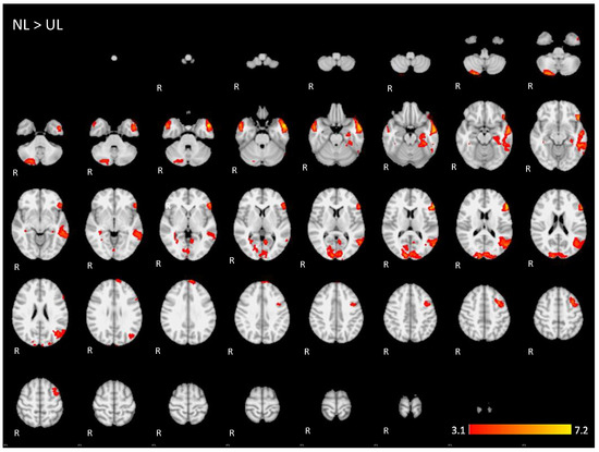Brainsci 11 01063 g0a3 550