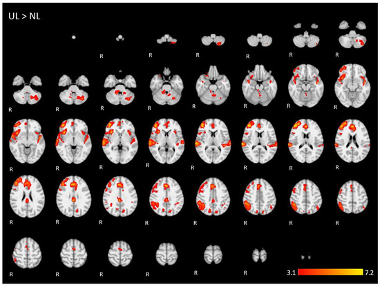 Brainsci 11 01063 g0a4 550