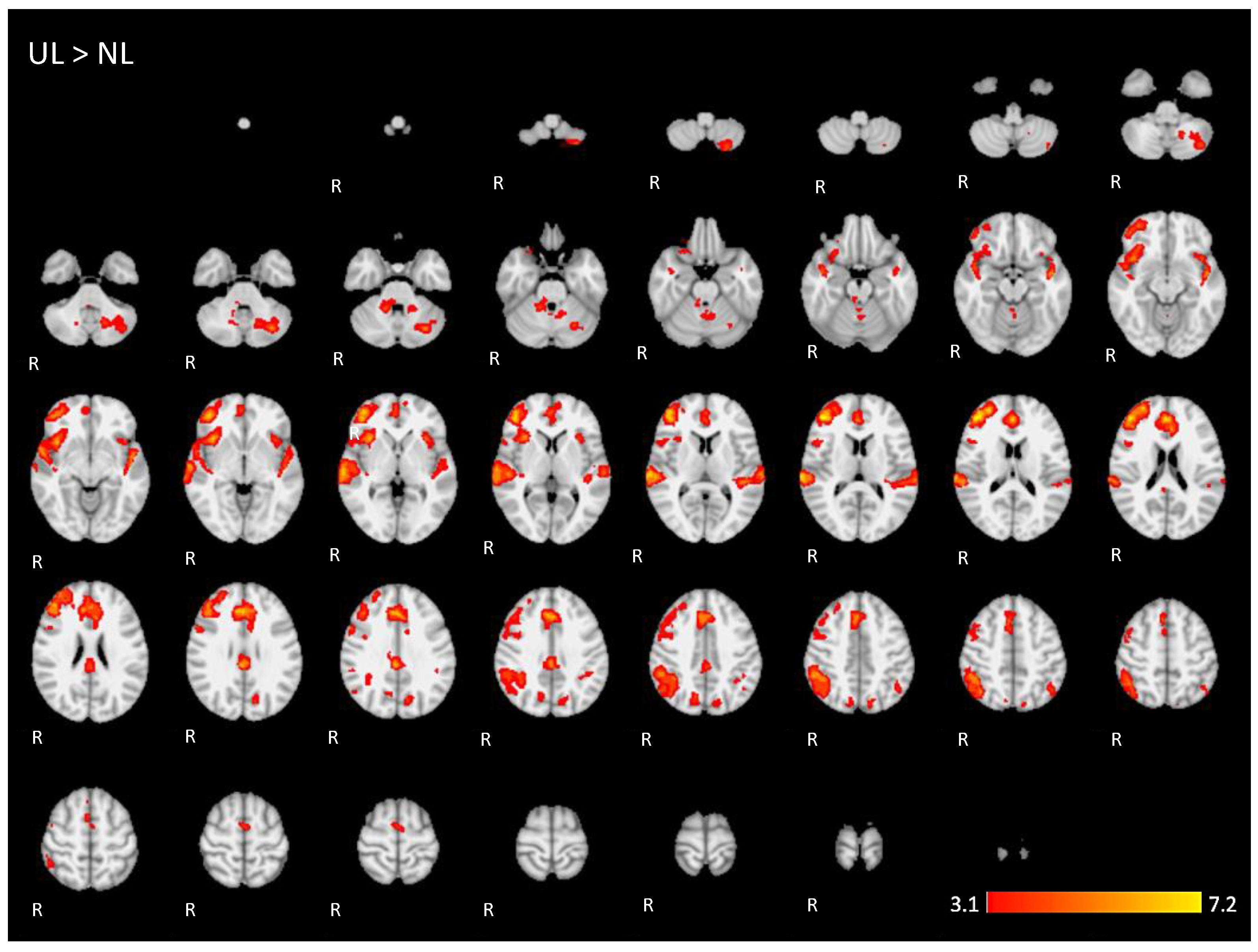 Brainsci 11 01063 g0a4