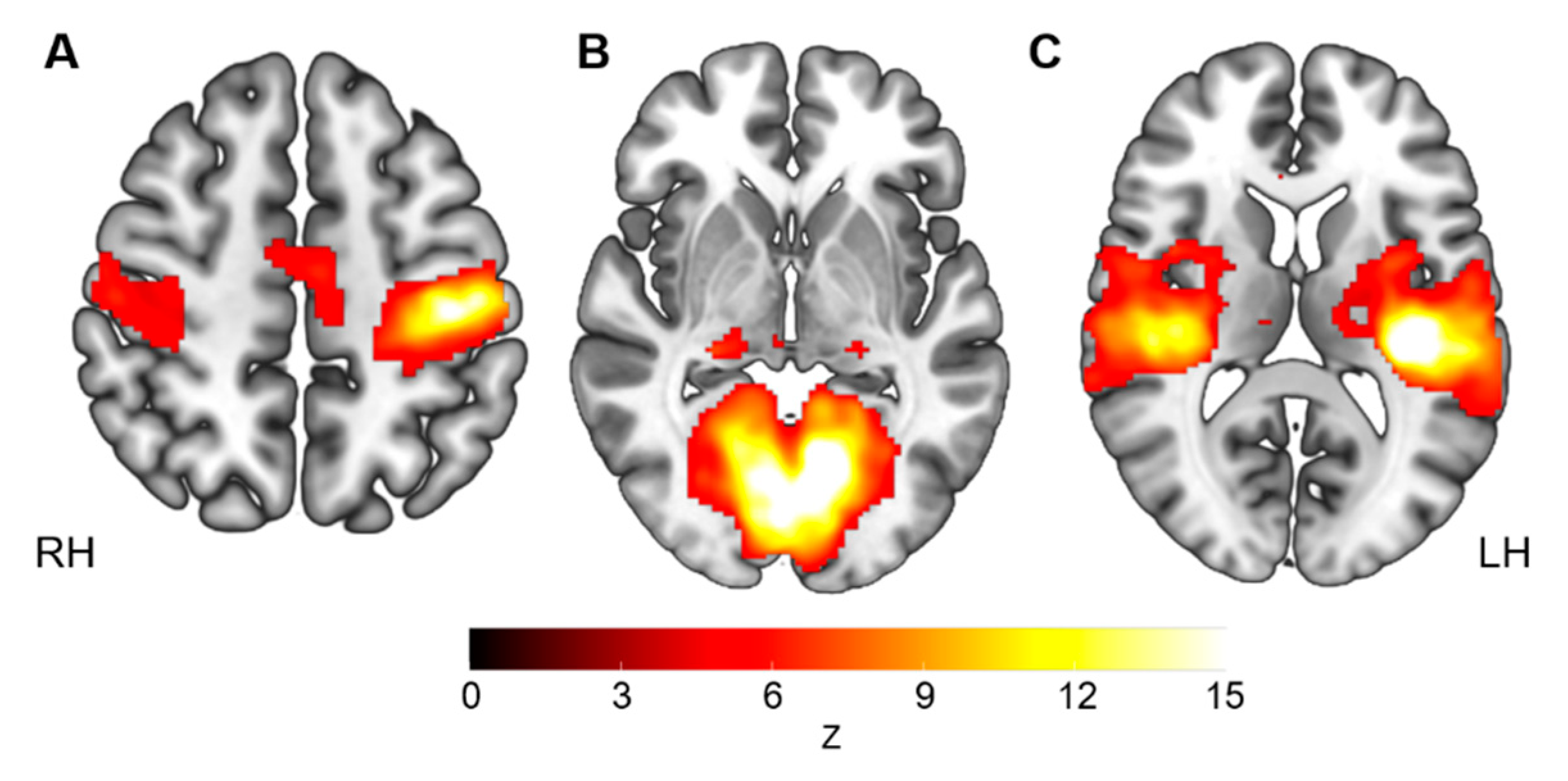 Brainsci 11 01065 g001