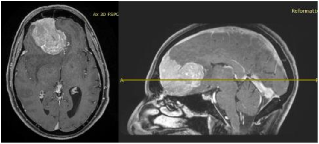 Brainsci 11 01076 g001 Brainsci 11 01076 g001