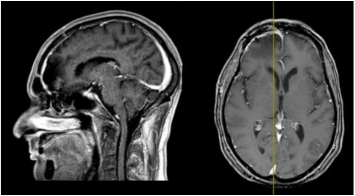 Brainsci 11 01076 g002 Brainsci 11 01076 g002