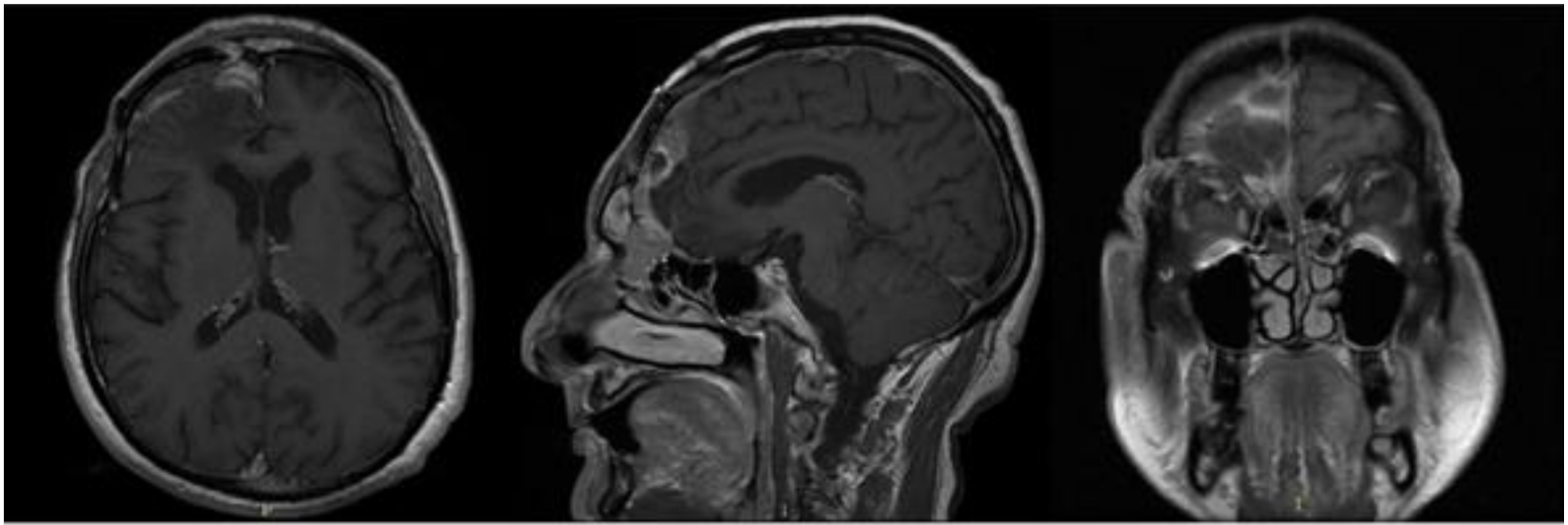 Brainsci 11 01076 g003 Brainsci 11 01076 g003