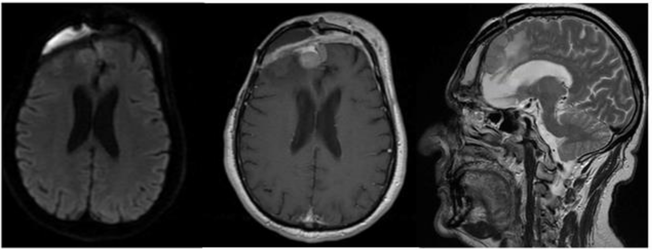 Brainsci 11 01076 g004 Brainsci 11 01076 g004